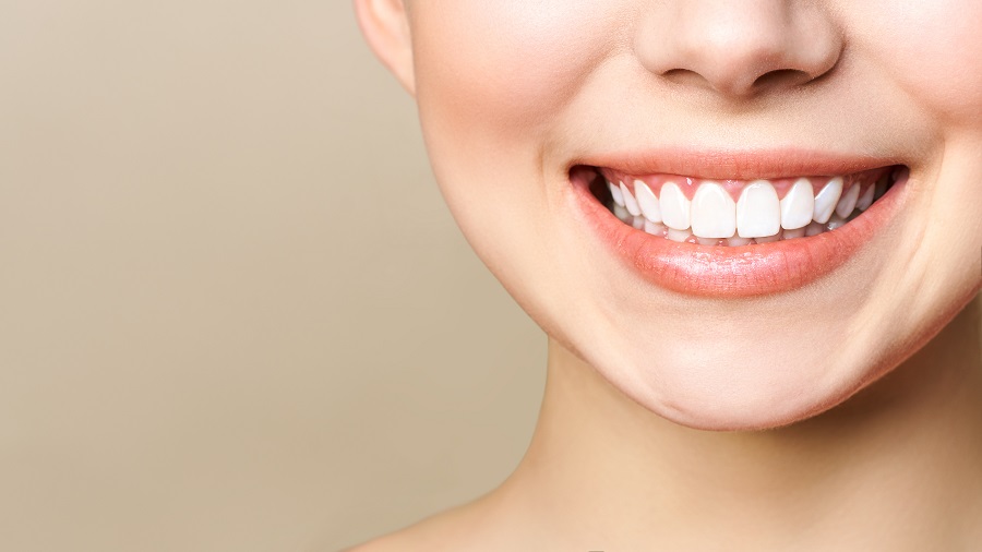 Dental Bonding Dental Bonding